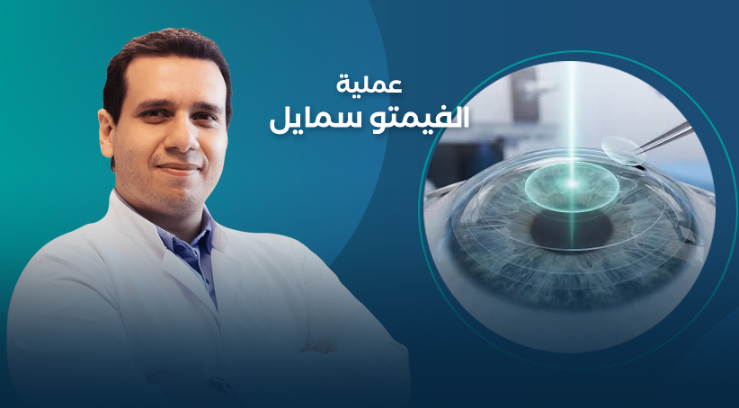 عملية الفيمتو سمايل