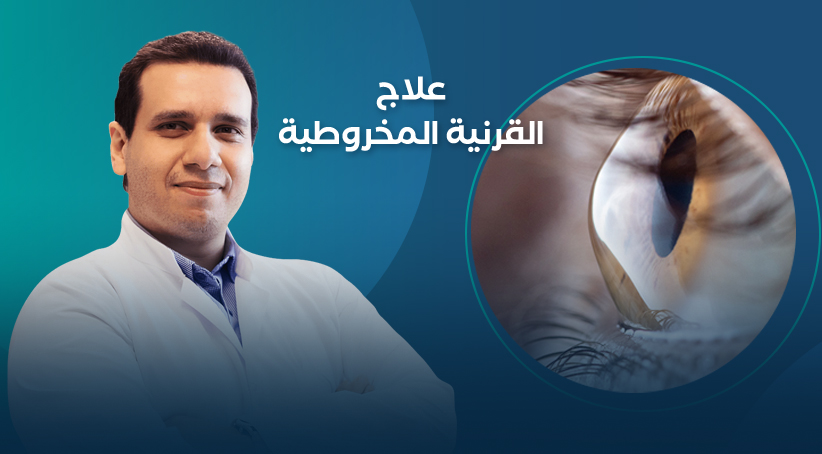 علاج القرنية المخروطية